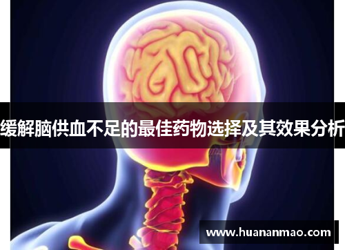 缓解脑供血不足的最佳药物选择及其效果分析 缓解脑供血不足的最佳药物选择及其效果分析